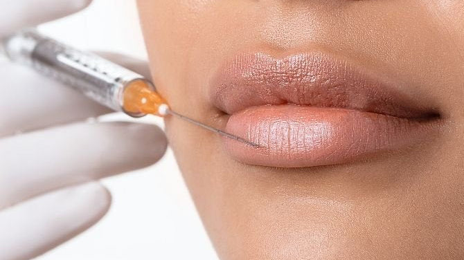 Comment le Botox agit-il sur le sourire gingival sans modifier la personnalité du sourire ?