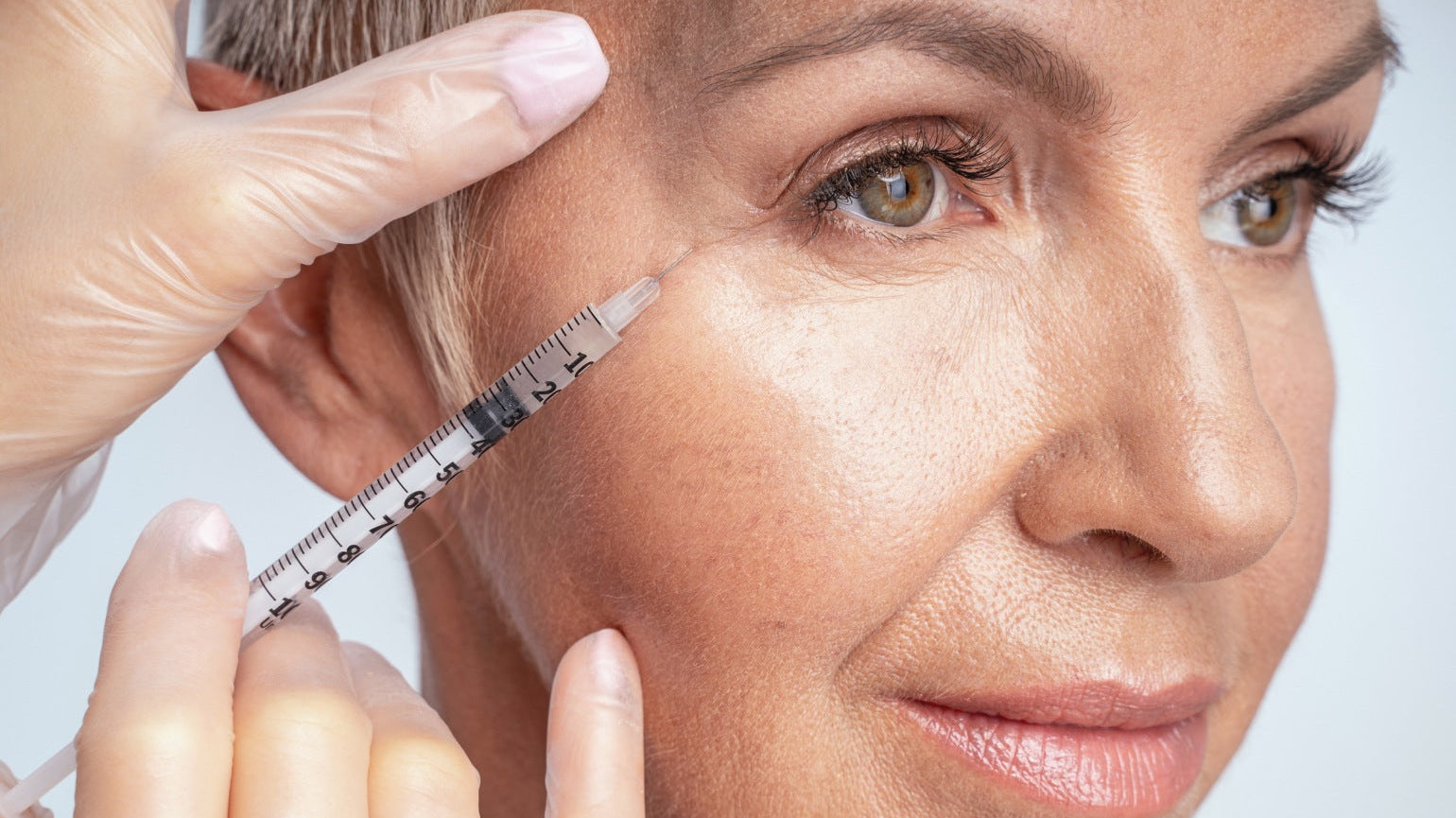 Quels résultats attendre après une injection de Botox pour les pattes d’oie et combien de temps durent-ils ?
