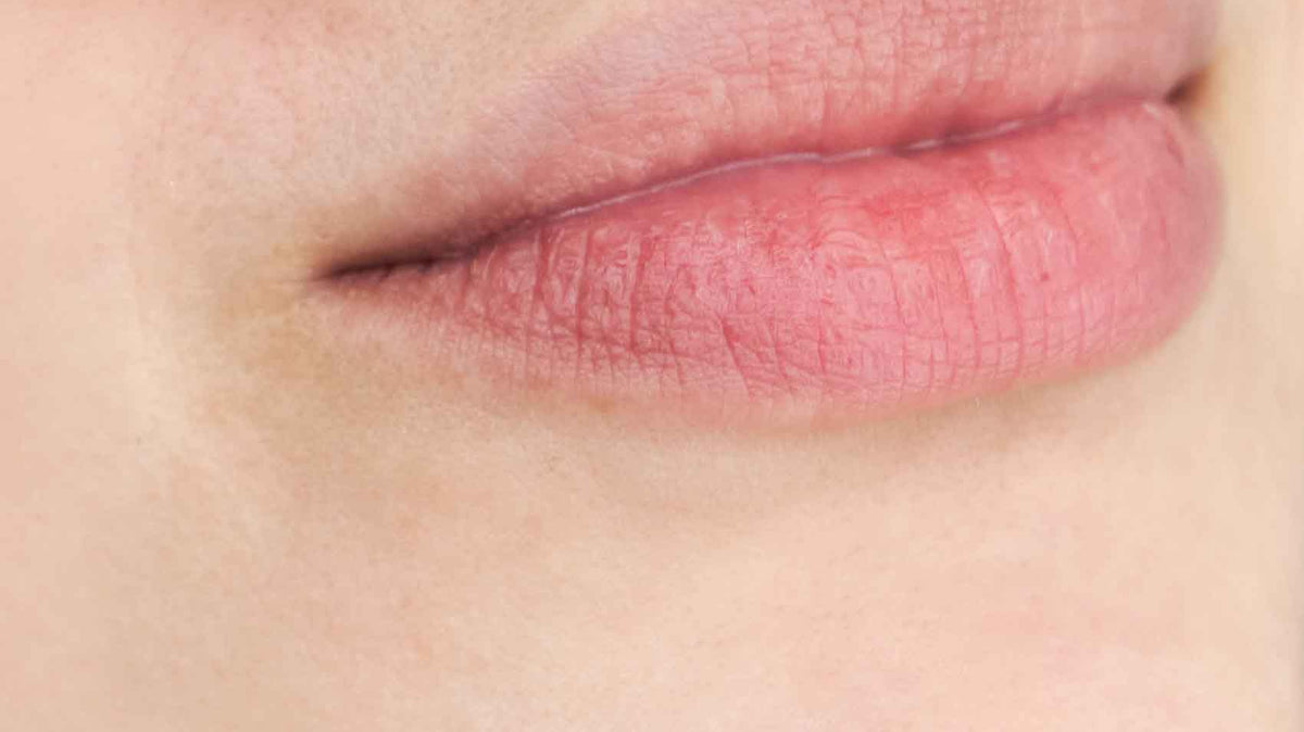 Comment se déroule une séance de Lip Flip au Botox ?