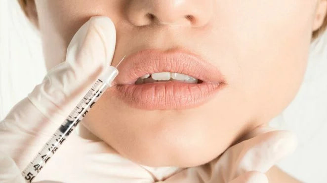 Quels résultats attendre d’un Lip Flip au Botox et combien de temps durent-ils ?