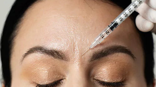 Quels résultats attendre après une injection de Botox pour les rides du lion et combien de temps durent-ils ?