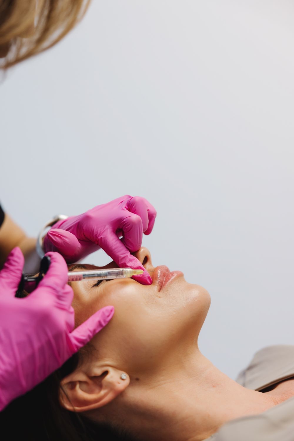 Les injections des lèvres donnent-elles un résultat naturel ?