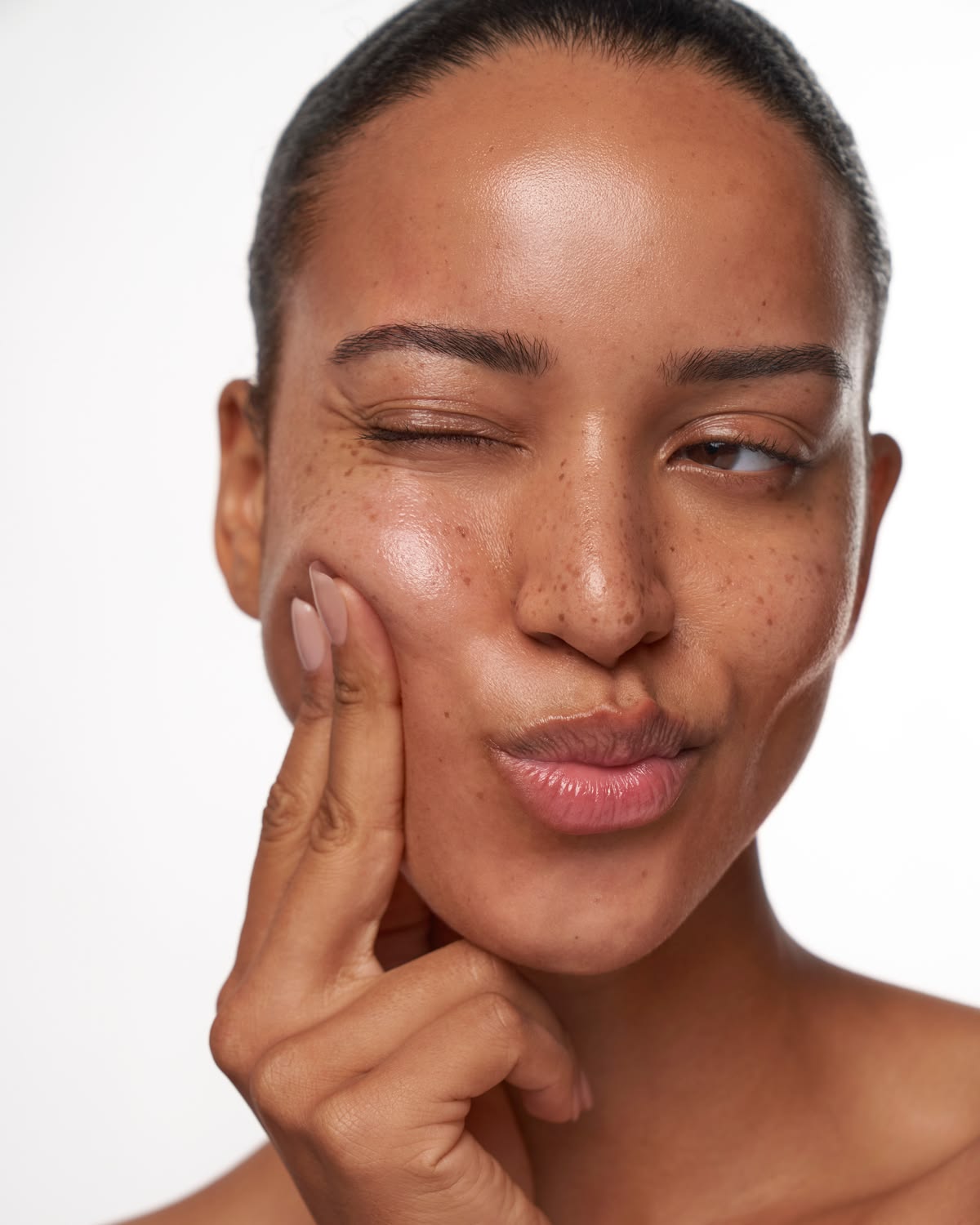 Mésothérapie vs injections pour les cernes : quelle solution choisir ?