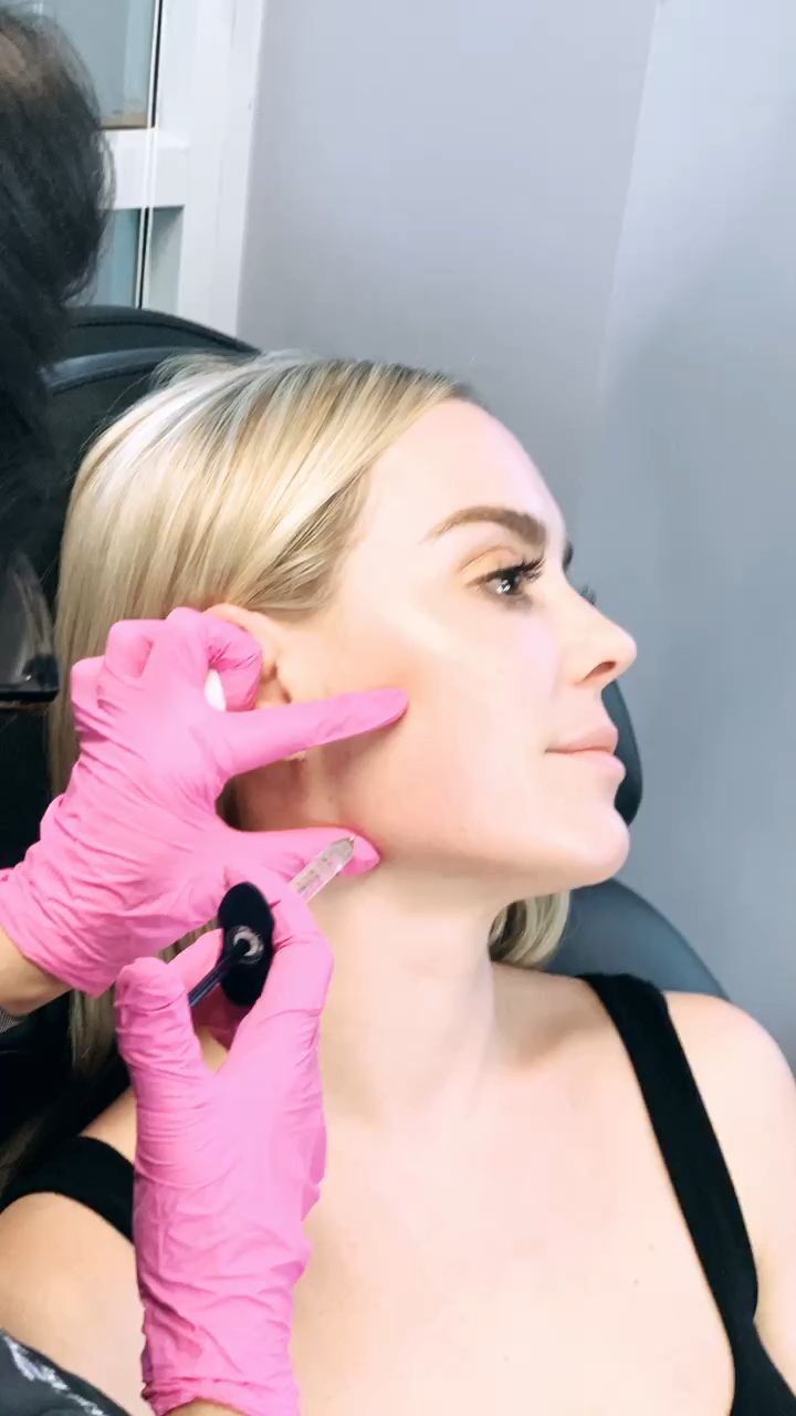 Jawline femme et jawline homme : quelles différences de traitement ?