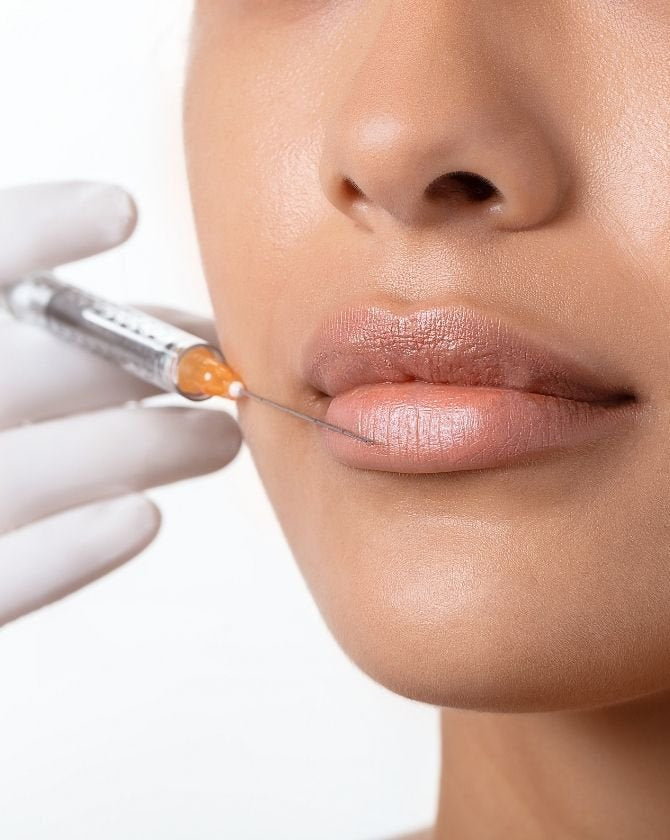 Comment le Botox agit-il sur le sourire gingival sans modifier la personnalité du sourire ?