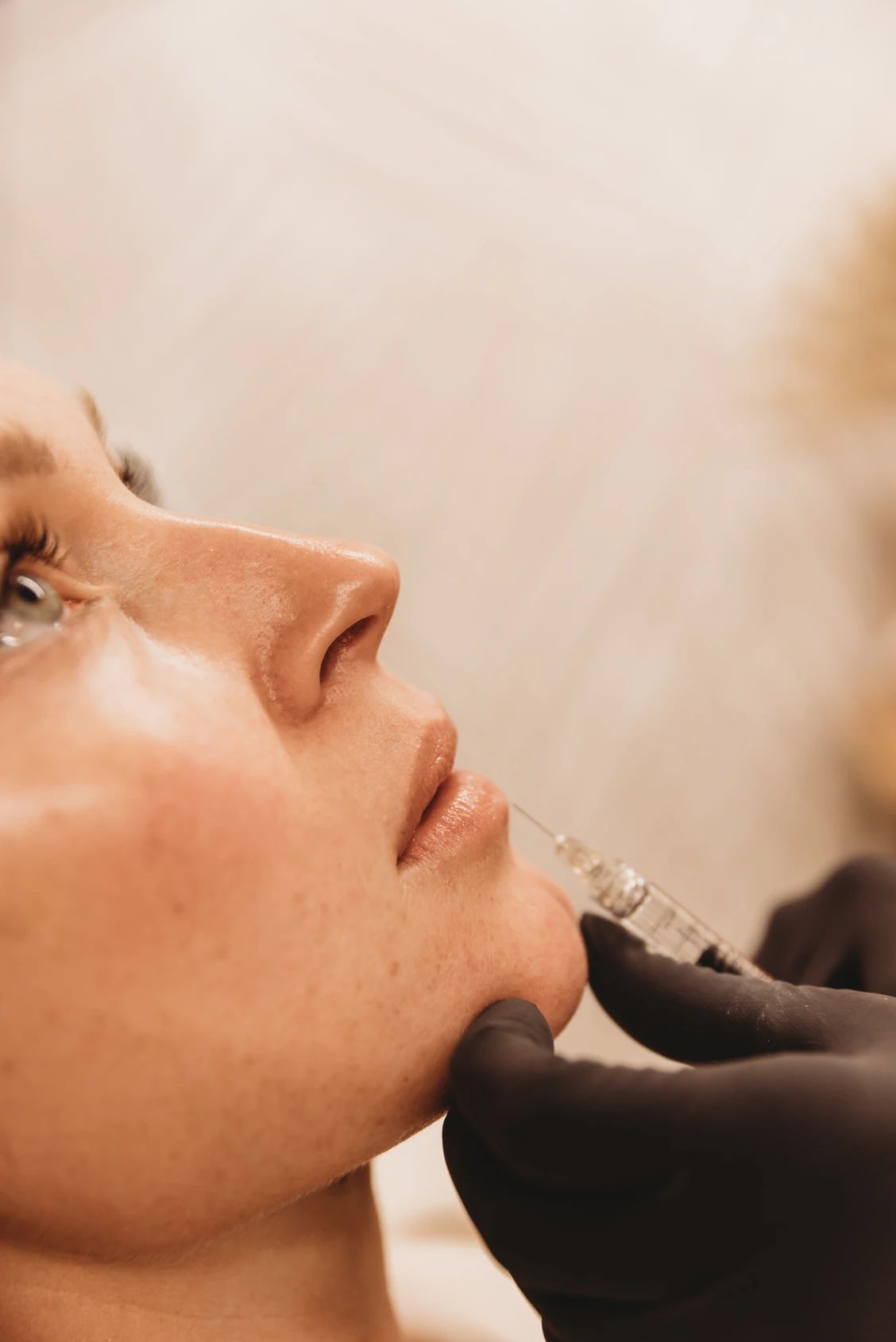 Combien de temps durent les injections des lèvres et quand faut-il faire une retouche ?