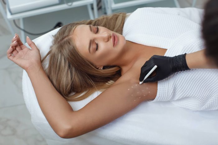Pourquoi souffre-t-on de transpiration excessive et en quoi le Botox est-il une solution efficace ?