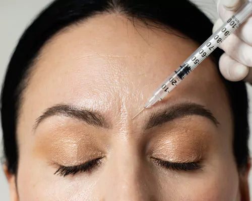 Quels résultats attendre après une injection de Botox pour les rides du lion et combien de temps durent-ils ?
